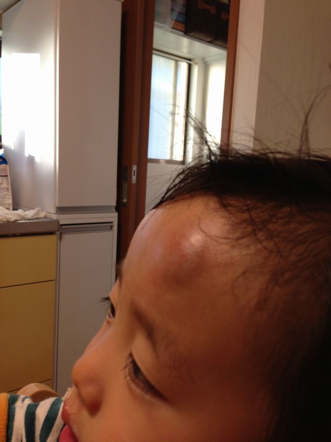 子どもヒヤリ ハット 03 子どもが頭を打ったら 私が病院で聞いた ４つのチェックポイント Cheers Mama チアーズ ママ チアママ